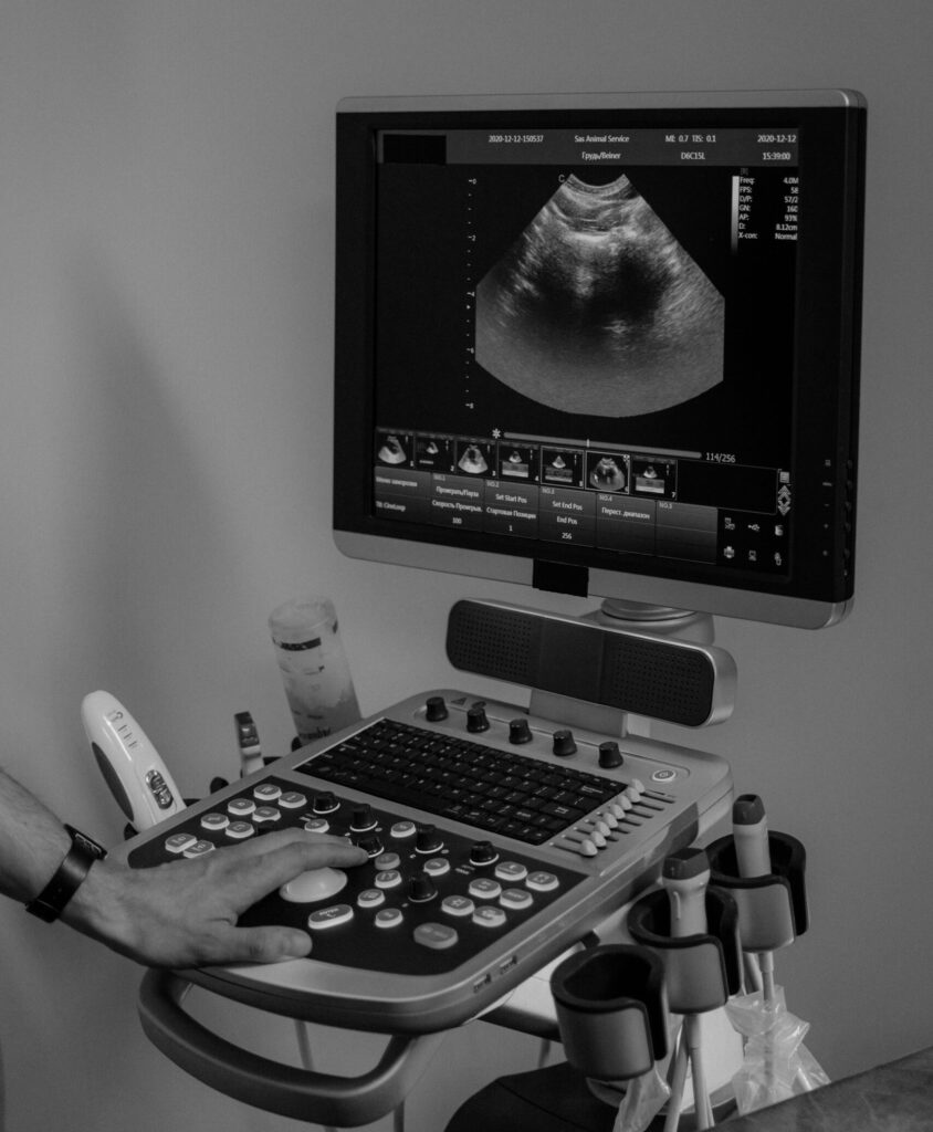 Close-up of a grayscale ultrasound machine in use, showing medical imaging on the screen.