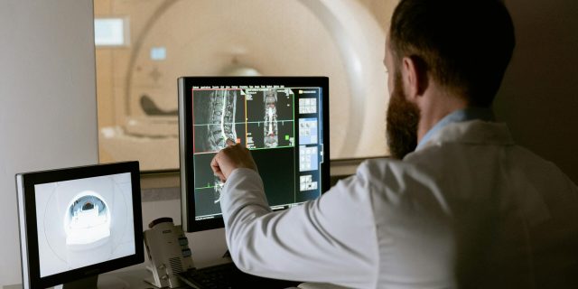 Medical professional reviewing MRI scans on computer screens for diagnostic purposes.